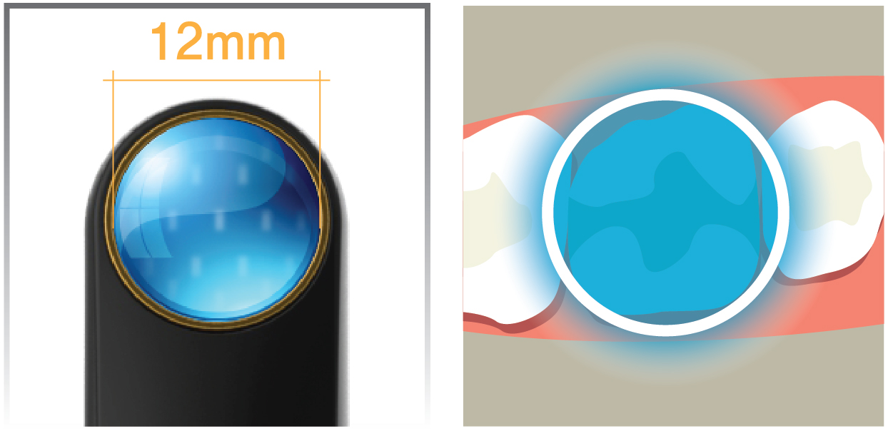 Wide irradiating surface with a diameter of 12mm